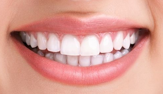 after whitening