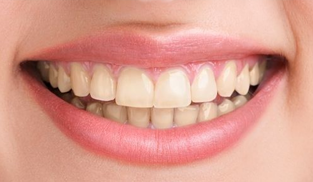 before whitening